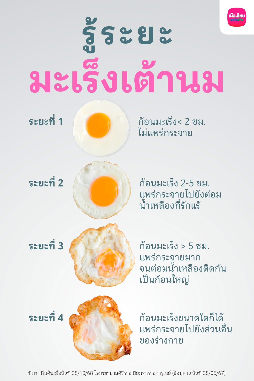 มะเร็งเต้านม ภัยเงียบที่ต้องรู้! สถิติ, อาการ, การรักษา และค่าใช้จ่าย ปี 2025 